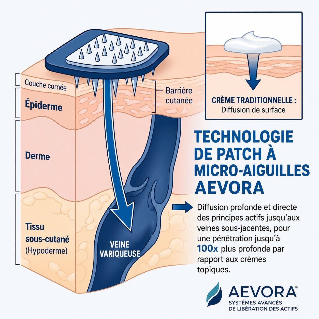 Patchs Veineux AEVORA® — Soulagez vos jambes sans crème, sans collant, sans chirurgie