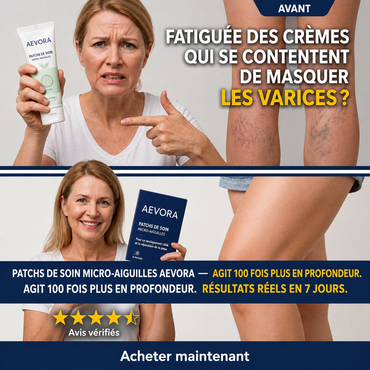 Patchs Veineux AEVORA® — Soulagez vos jambes sans crème, sans collant, sans chirurgie
